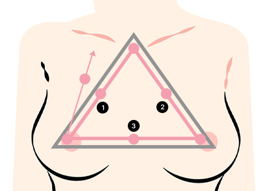 A-Top Plastic Surgery Mentor Extra: The Difference Created by Technological Skills and Detail