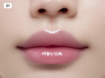 에이탑성형외과 C컬라인 인중오목술 수술방법