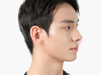 에이탑성형외과 직선라인 코성형 옆 라인 더블체크