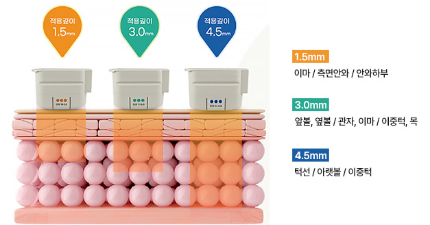 A-Top Plastic Surgery Ultherapy Prime 3 types of transducers