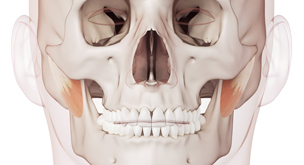A-Top Plastic Surgery: Precise analysis of skeletal structure, nasolabial groove, and soft tissue for aristocratic surgery