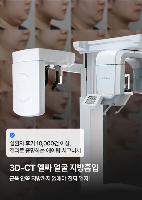 에이탑성형외과 3D-CT 엘싸 얼굴 지방흡입
