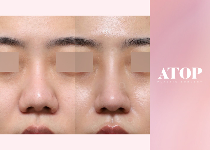 คอลัมน์ทางการแพทย์_ฉบับที่ 06 - ศัลยกรรมตกแต่งชั้นนำ